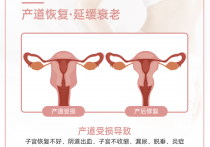 月嫂要知道的产后知识，产后修复别乱做，4个不推荐，3个推荐做的产后修复，月嫂要记住